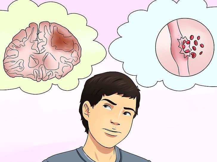 3 способа распознать инсульт